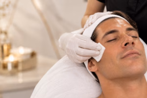 VI Peel for Sun Damage